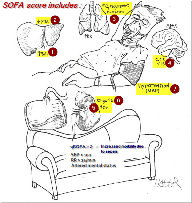 Sequential Organ Failure Sment