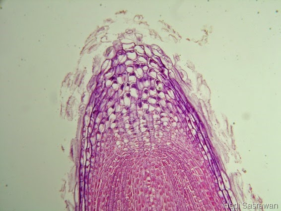 Jaringan meristem pada ujung akar