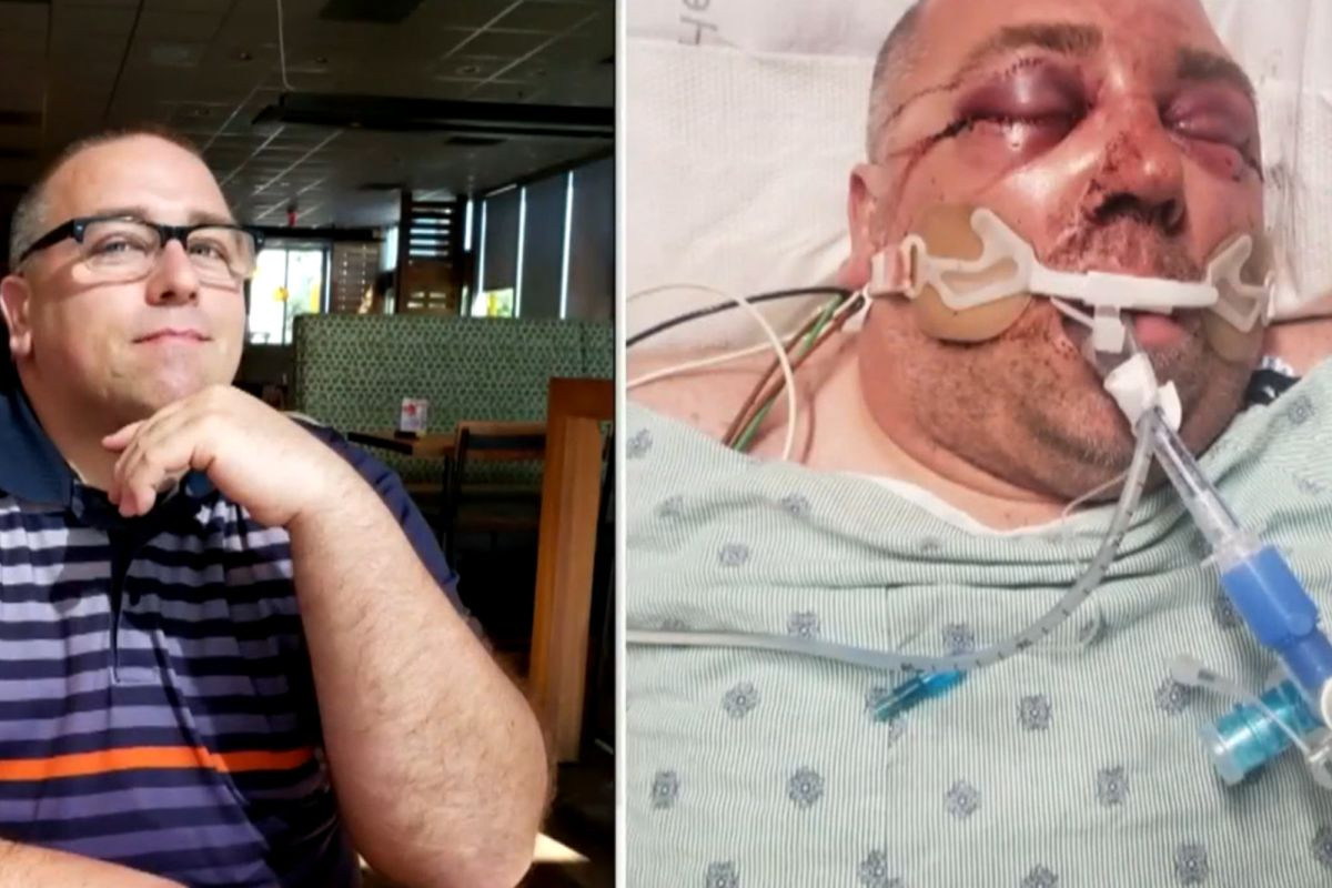 Man left unrecognizable and put in coma after he's brutally beaten for asking neighbors to lower music