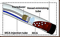 Ultrassom Ultrassom