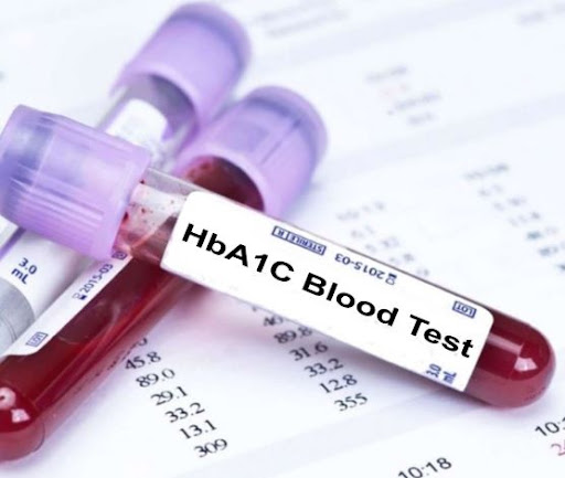 Seaview Hba1c Testing