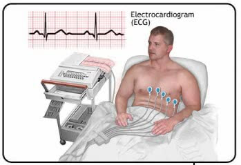  كتاب ecg pdf