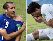 Italy's defender Giorgio Chiellini (L) showing an apparent bitemark and Uruguay forward Luis Suarez (R) holding his teeth after the incident Picture: AFP