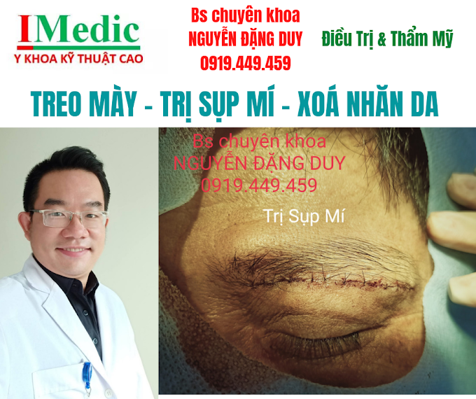 Treo mày trị sụp mí Xoá nếp nhăn mày , mí Cà Mau | Mỹ Viện Nano Cà Mau | Phẫu thuật thẩm mỹ Cà Mau | Phòng Khám Chuyên Khoa Kỹ Thuật Cao IMedic.vn | Bs chuyên khoa NGUYỄN ĐẶNG DUY 0919449459