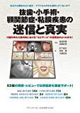 抜歯・小手術・顎関節症・粘膜疾患の迷信と真実