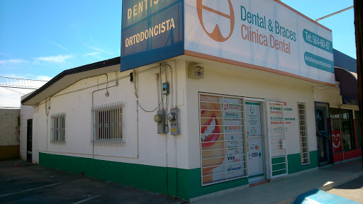 Dental & Braces, 301-C, Calz Independencia, Insurgentes Oeste, 21280 Mexicali, B.C., México, Mecánico protésico dental | BC