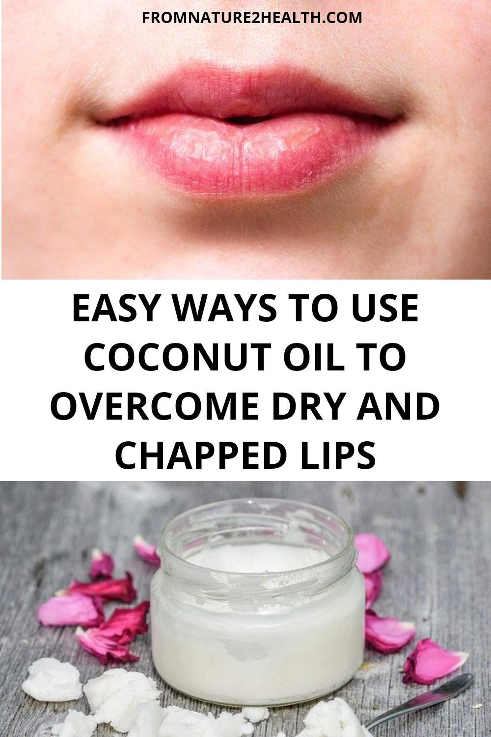 Easy Ways to Use Coconut Oil to Overcome Dry and Chapped Lips