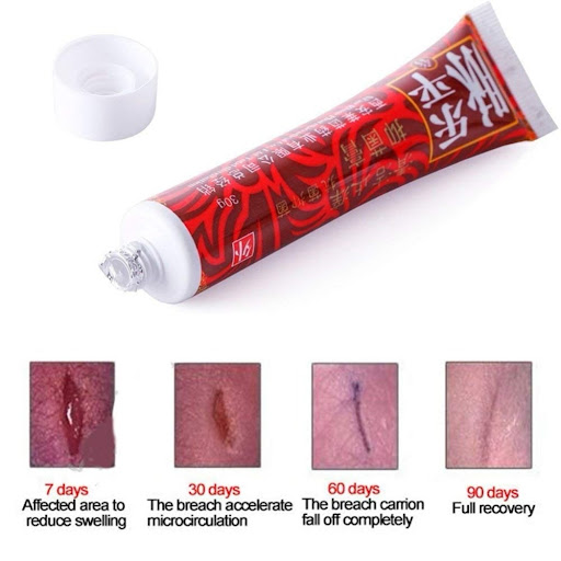 Title 4, VEINS TREATMENT CREAM