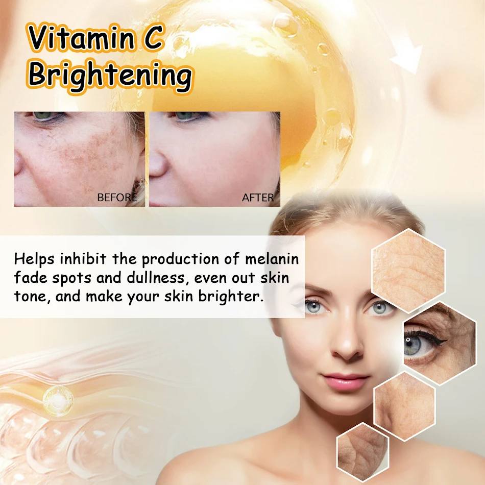 Acne Nourishing And Brightening Cream Reduces blemishes, evens skin tone, and nourishes skin. Achieve clearer and more r