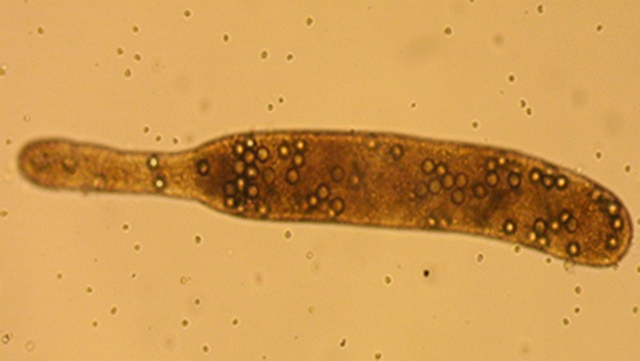 Microplastic particles ingested by a copepod. Photo: Cole, et al., 2016 / Environmental Science and Technology