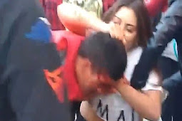 Pejambret Ponsel Ini Berdarah-darah karena yang Dijambret Wanita Petarung mma