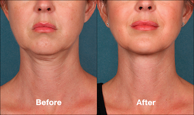 Photos of Laser and Skin Surgery Center