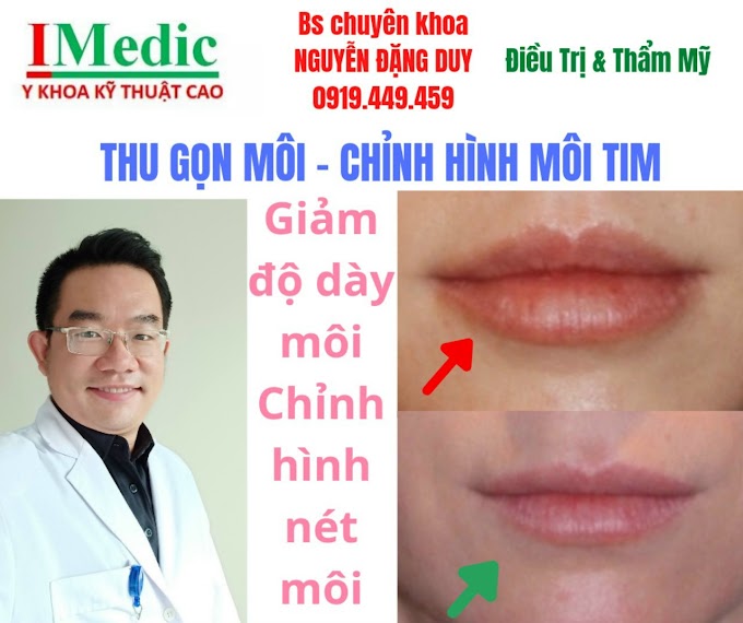 Thu gọn môi tạo hình môi trái tim tại Cà Mau chỉnh hình môi chỉnh sửa môi sẹo môi do sinh hoạt tại Cà Mau Mỹ viện Nano Phòng khám chuyên Kỹ Thuật Cao IMedic Y Khoa Kỹ Thuật Cao Phẫu thuật thẩm mỹ Cà Mau Sài Gòn Bs chuyên khoa NGUYỄN ĐẶNG DUY 0919449459