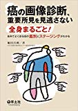 癌の画像診断、重要所見を見逃さない〜全身まるごと! 各科でよく診る癌の鑑別とステージングがわかる