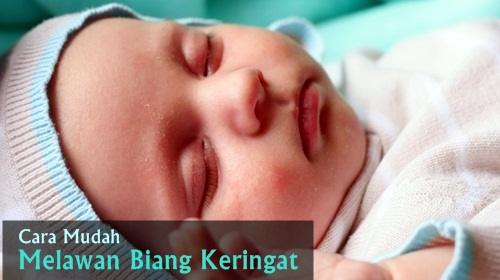 cara mengatasi biang keringat pada bayi