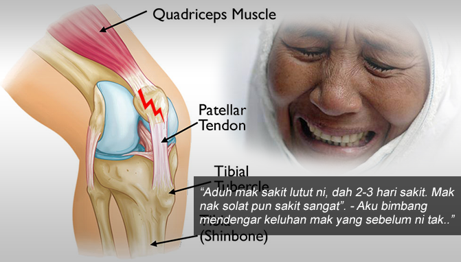 Ubat TERBAIK Untuk Masalah Sakit Sendi Dan Sakit Lutut 