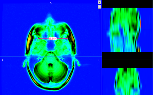 MRI Scalar Preview image 4