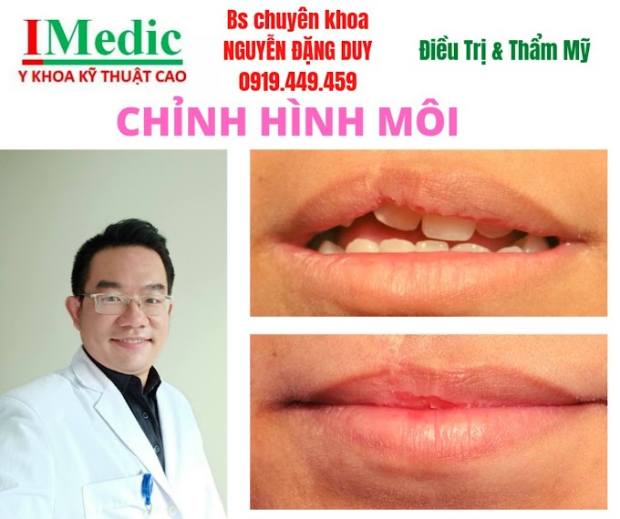 Trị sẹo môi Cà Mau Thẩm mỹ xoá sẹo xấu lâu năm biến dạng Cà Mau Mỹ viện Nano Phòng khám chuyên khoa Kỹ Thuật Cao IMedic Y Khoa Kỹ Thuật Cao Phẫu thuật thẩm mỹ Cà Mau Sài Gòn Bs chuyên khoa NGUYỄN ĐẶNG DUY 0919449459