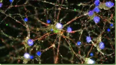 02-C4-Protein-schizophrenia brain map