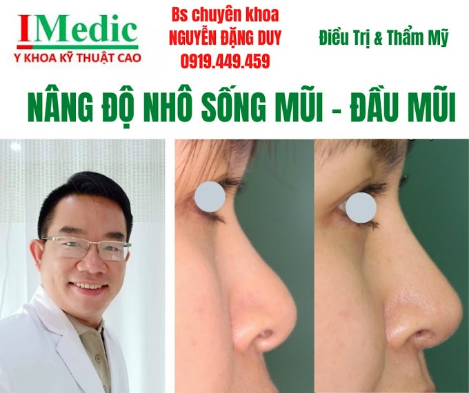 Sửa mũi thẩm mỹ Cà Mau Nâng mũi Cà Mau Chỉnh hình mũi thẩm mỹ Cà Mau Mỹ viện Nano Phòng khám chuyên khoa Kỹ Thuật Cao IMedic Y Khoa Kỹ Thuật Cao Phẫu thuật thẩm mỹ Cà Mau Sài Gòn Bs chuyên khoa NGUYỄN ĐẶNG DUY 0919449459