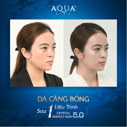 Aqua Clinic ra mắt công nghệ căng bóng da hiện đại bậc nhất - Ảnh 1.