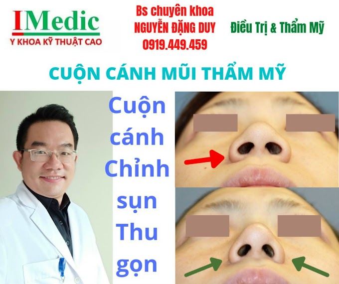 Khép cuộn cánh mũi phong thủy thẩm mỹ Cà Mau cắt cánh mũi nâng mũi thẩm mỹ Cà Mau Mỹ viện Nano Phòng khám chuyên  Kỹ Thuật Cao IMedic Y Khoa Kỹ Thuật Cao Phẫu thuật thẩm mỹ Cà Mau Sài Gòn Bs chuyên khoa NGUYỄN ĐẶNG DUY 0919449459