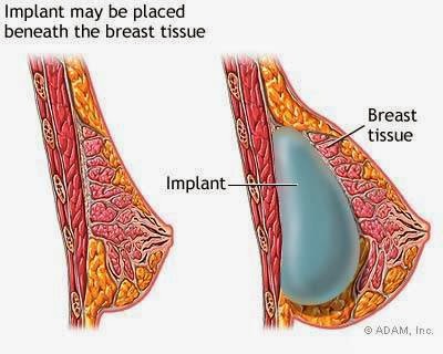 Dr. Deepa Tayal, Fortis La Femme, S-549, Greater Kailash Part- 2, Block E, New Delhi, Delhi 110048, India, Oncologist, state DL