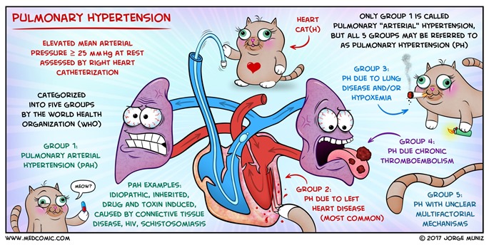 Pulmonary_Hypertension