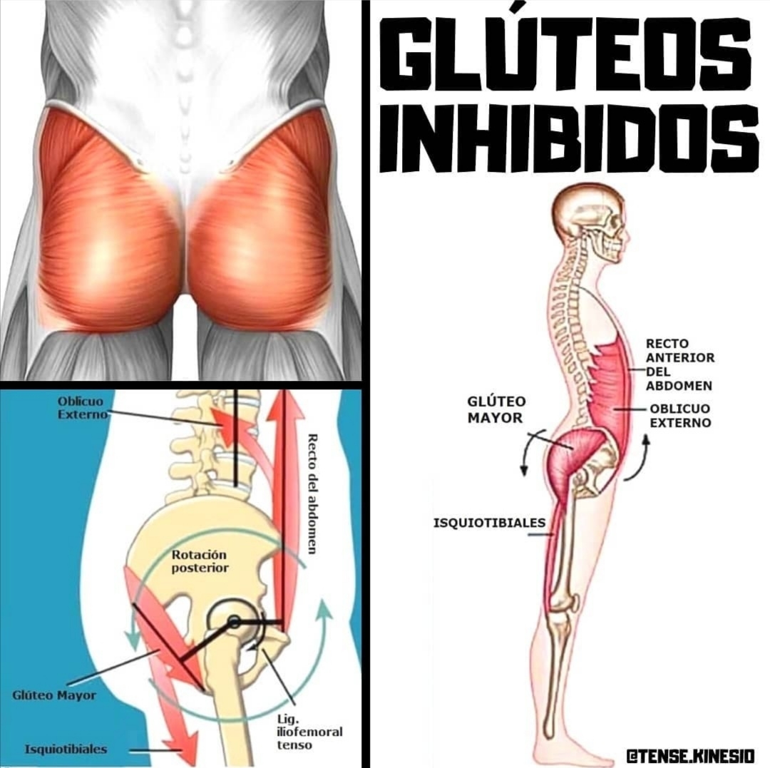 📷☝️GLUTEOS INHIBIDOS‼️🤦‍♂️