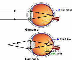 Gambar