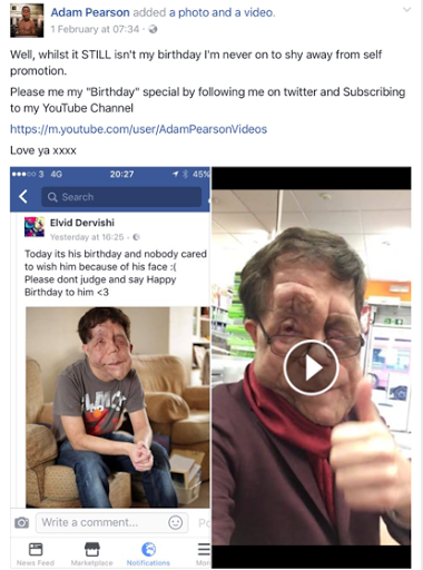 facebook post from Adam Pearson - You can see the original post misusing Adam's photo on the left - saying no one wished him a happy birthday because of his facial disfiguremeant, and asking people to wish him happy today and not to judge. On the right is a still from a video from Adam.