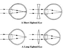 Long and short sighted correction