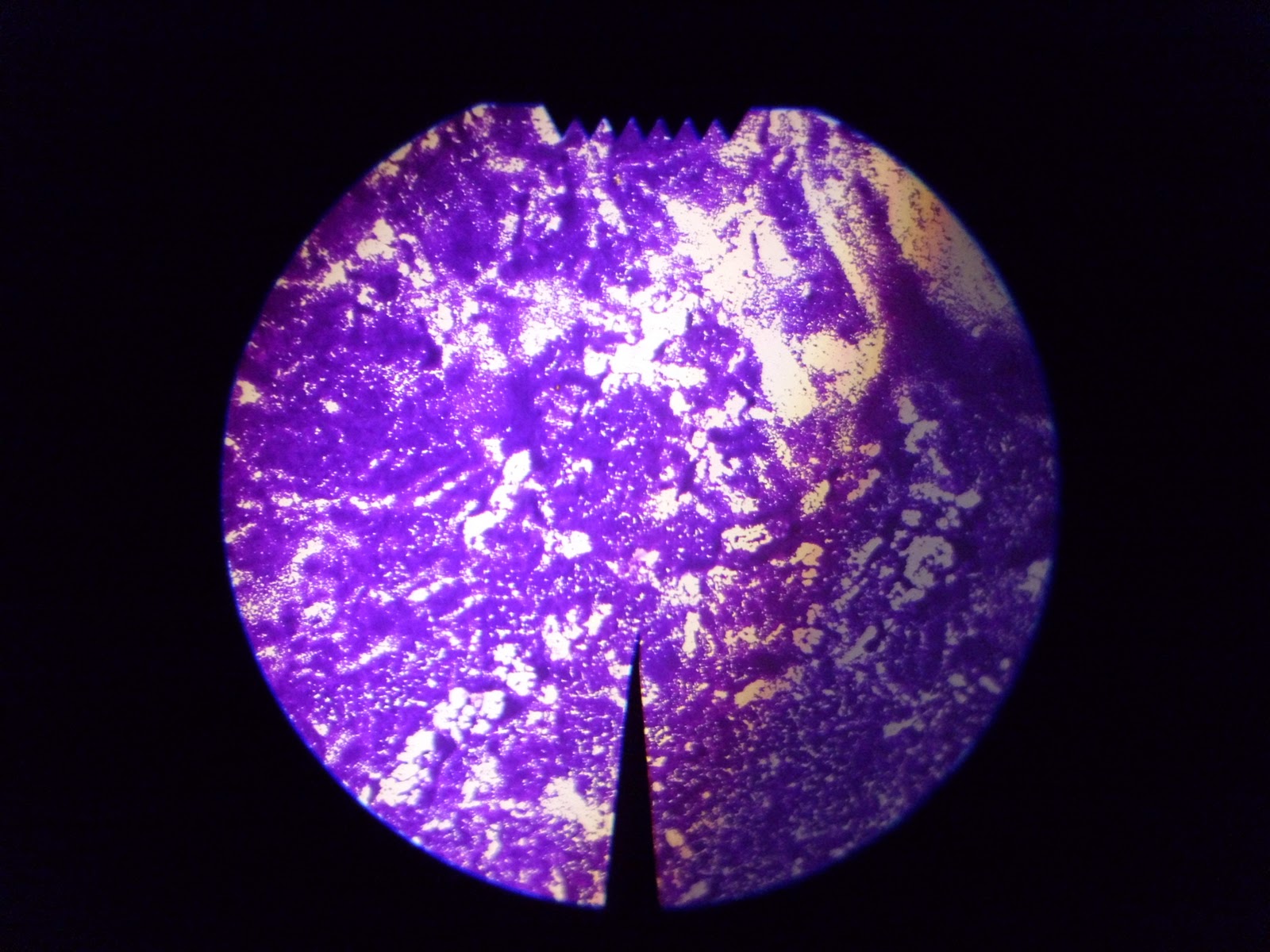 Microbediscoveries Simple Stain