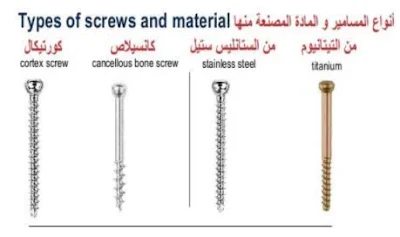 شرائح ومسامير العظام