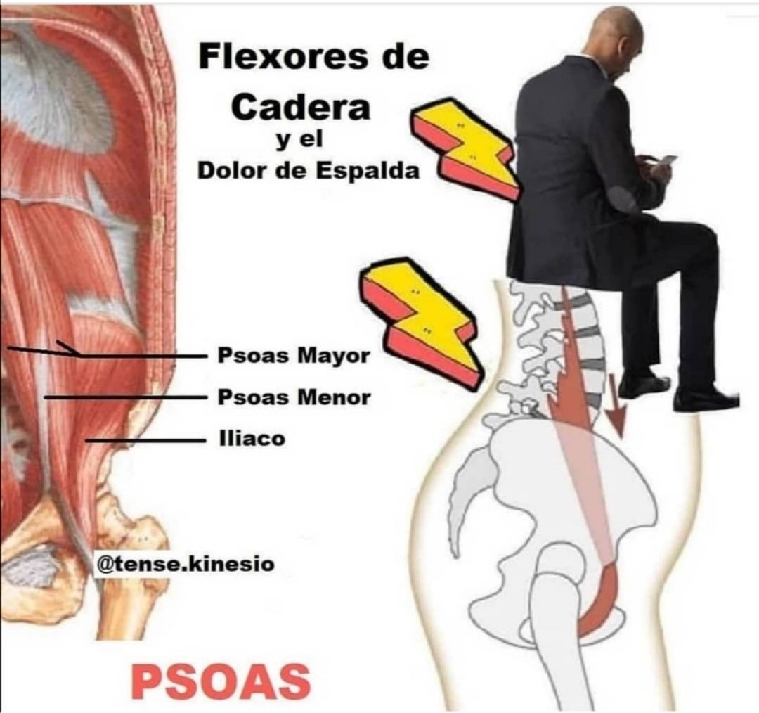 ☝️📸DOLOR LUMBAR POR TENSIÓN DEL PSOAS⁉️(parte 2️⃣)