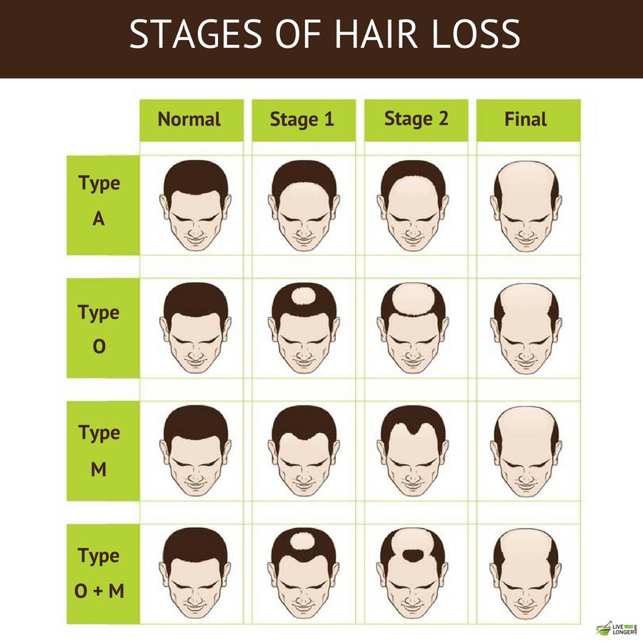 Men S Non Surgical Hair Loss Solutions Live Class