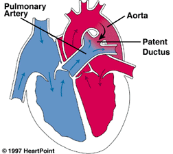 파일:external/www.heartpoint.com/pda.gif