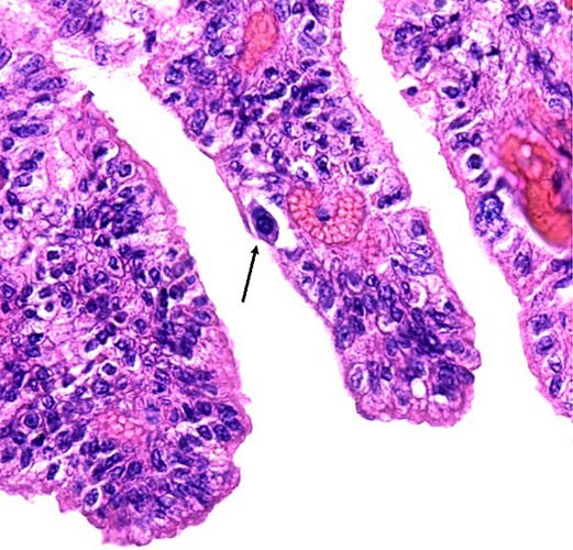 Villous surface with binucleate trophoblast at arrow