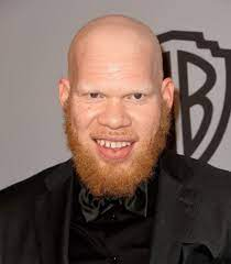 Krondon Net Worth, Age, Wiki, Biography, Height, Dating, Family, Career