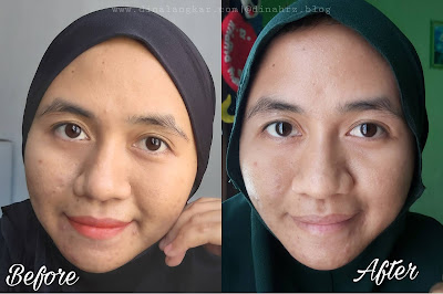 Hasil menggunakan serum pencerah