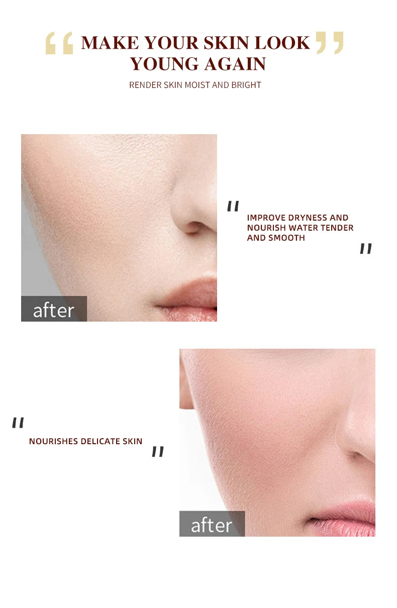 Title 2, Honing Afscheurmasker voor Mee-eters, Acne en H...