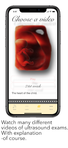 Screenshot ScanBaby learn baby ultrasound