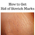 How to get rid of stretch marks1.5