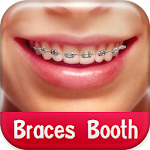 Braces Booth Apk