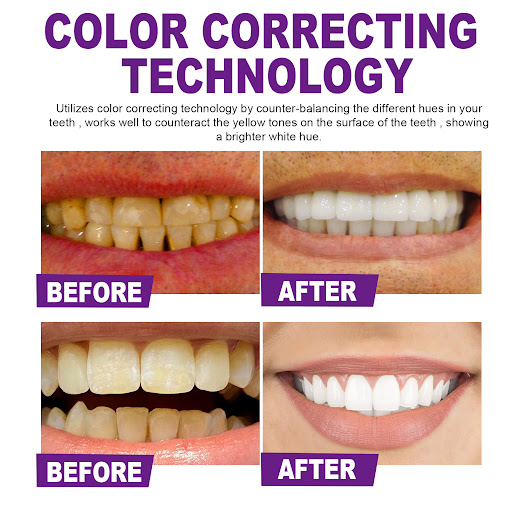 Title 3, Purple Whitening Toothpaste Cleaning Care. Achi...
