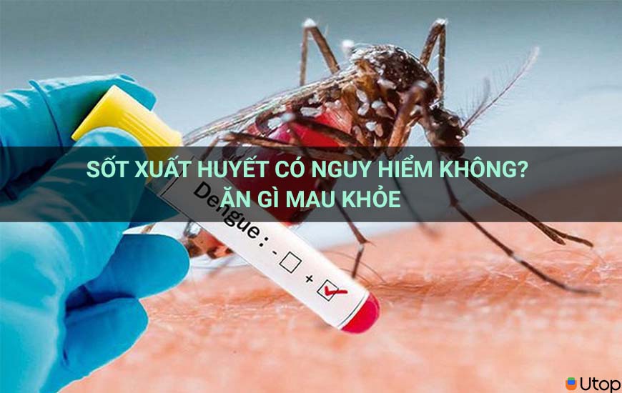 Sốt xuất huyết có nguy hiểm không?  Bạn nên ăn gì để tốt cho sức khỏe?