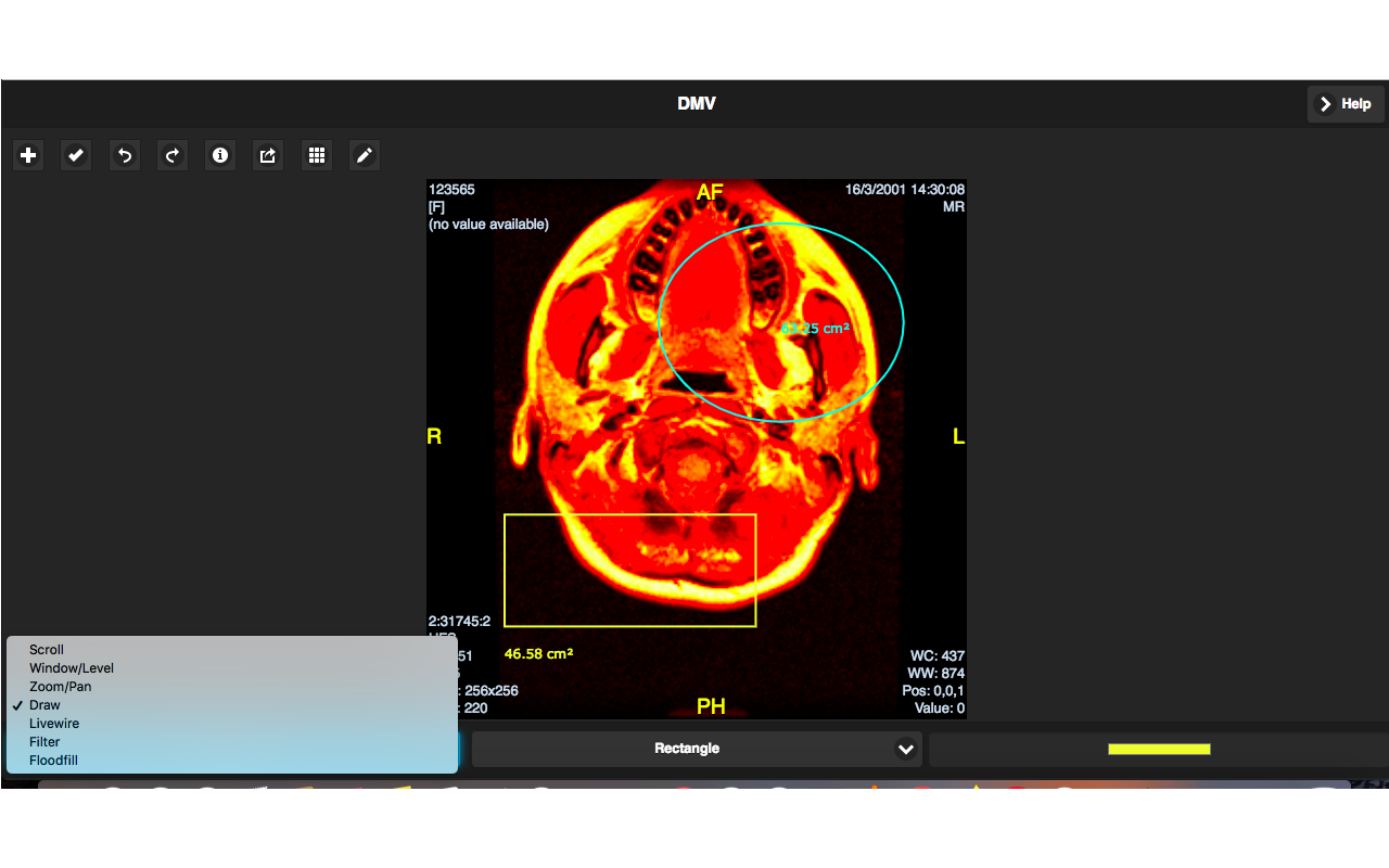 Dicom Medical Viewer Preview image 6