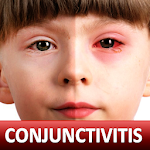 Cover Image of Herunterladen Help for Baby Conjunctivitis & Pinkeye in Children 1.5 APK