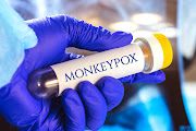 The National Institute for Communicable Diseases says healthcare workers should be on high alert for monkeypox.