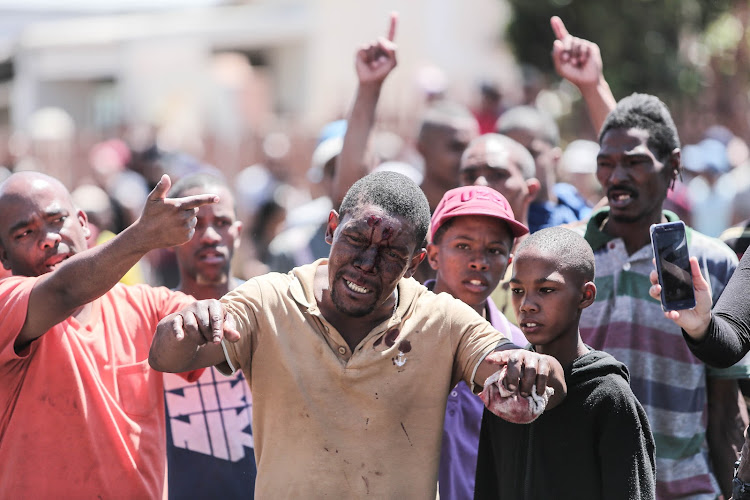 A injured man shows his anger after being shot with a rubber bullet by police in Westbury, Johannesburg, on October 1 2018.